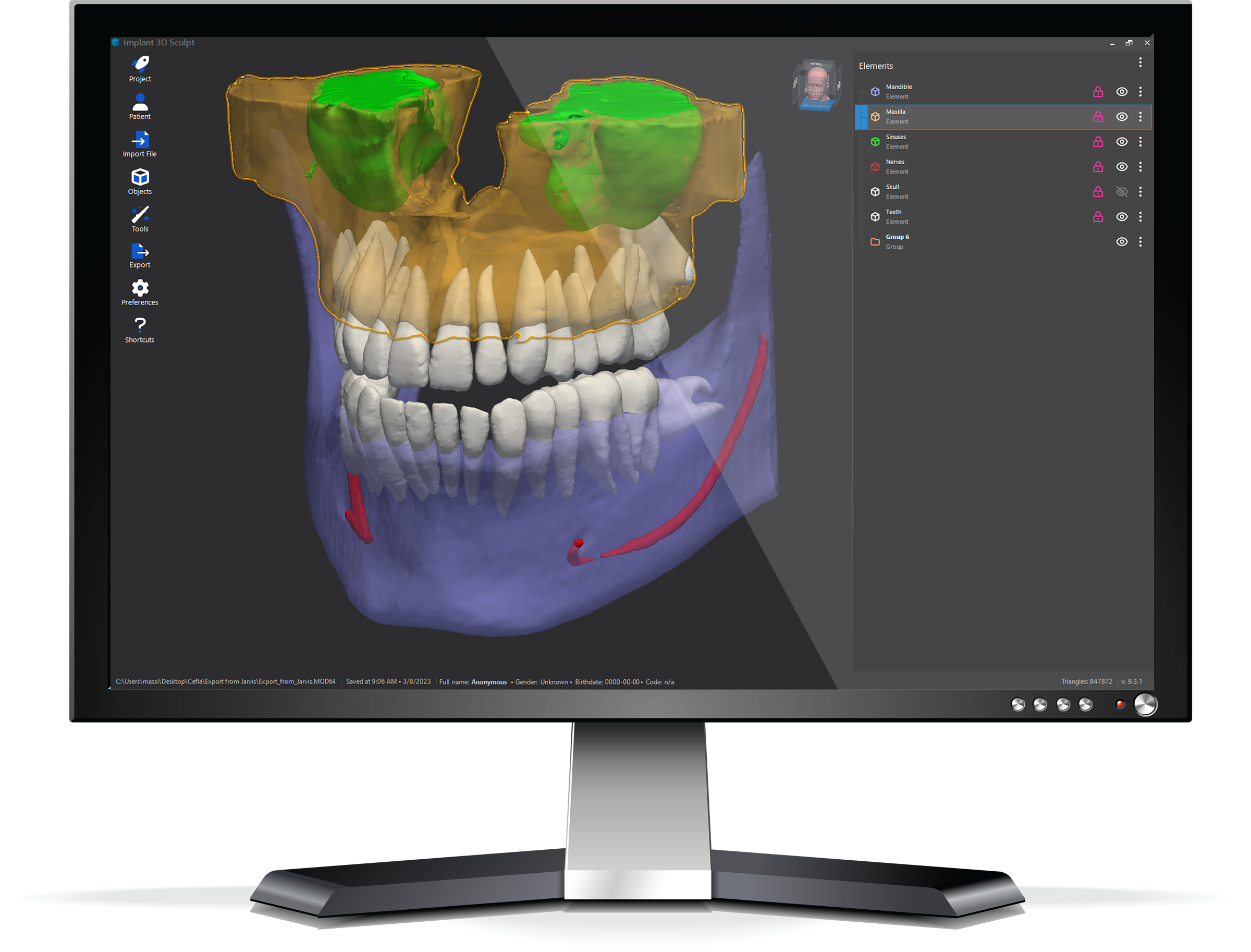 Intelligenza artificiale in odontoiatria